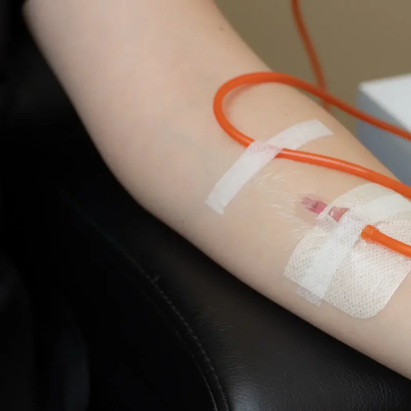 Detalle de la vía intravenosa fijada con apósito estéril en el antebrazo